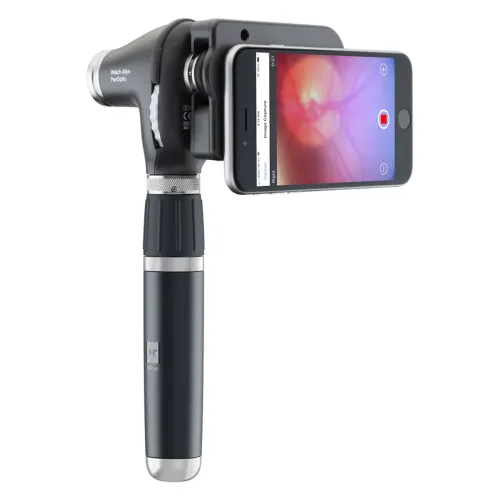 Welch Allyn 118-3 PanOptic Plus Ophthalmoscope Welch Allyn 118-3 PanOptic Plus Ophthalmoscope