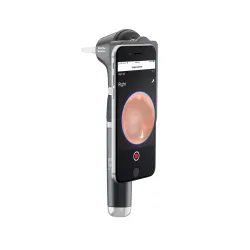 Welch Allyn 238-3 MacroView Plus Otoscope